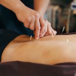 Acupuncture session in Japanese medical study. Young woman is lying on a mat while the operator inserts needles